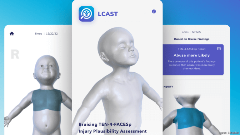 LCAST screenshots with a 3D model